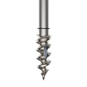 FIX CROSS 5.0 TI-ANCLAS DE TITANIO ø5mm