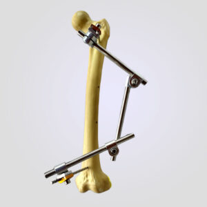 TUTOR TUBULAR CON ROTULAS POLIAXIALES