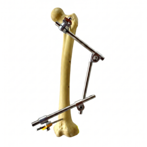 TUTOR TUBULAR CON ROTULAS POLIAXIALES