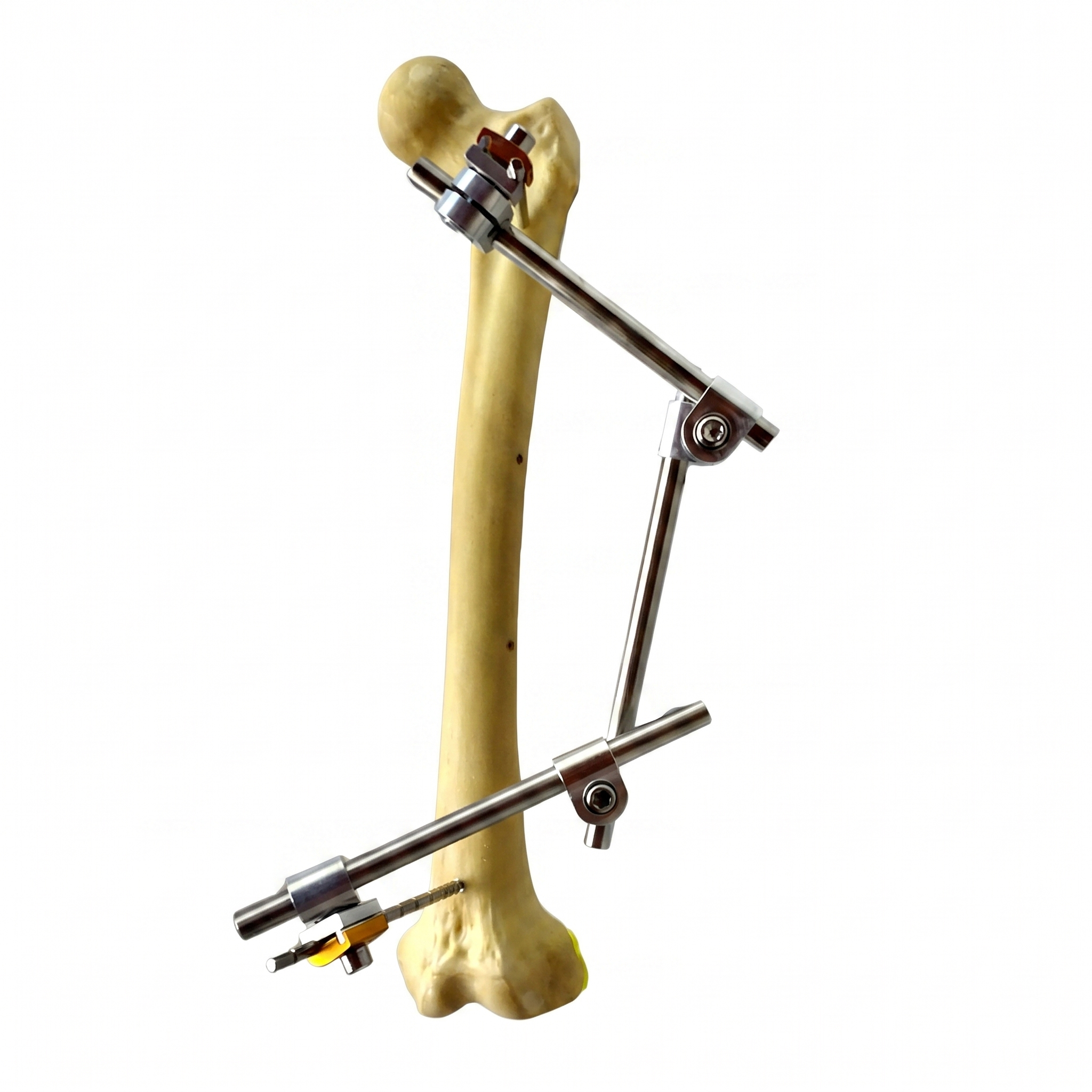TUTOR TUBULAR CON ROTULAS POLIAXIALES